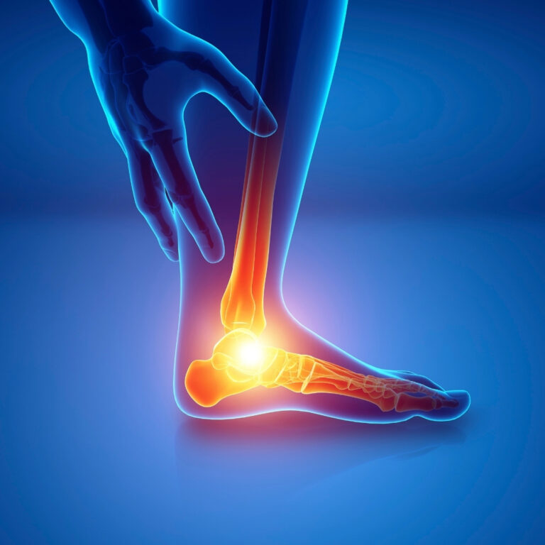 Say Goodbye to Knee Pain: A Drug-Free Approach with Neurotherapy in Kota